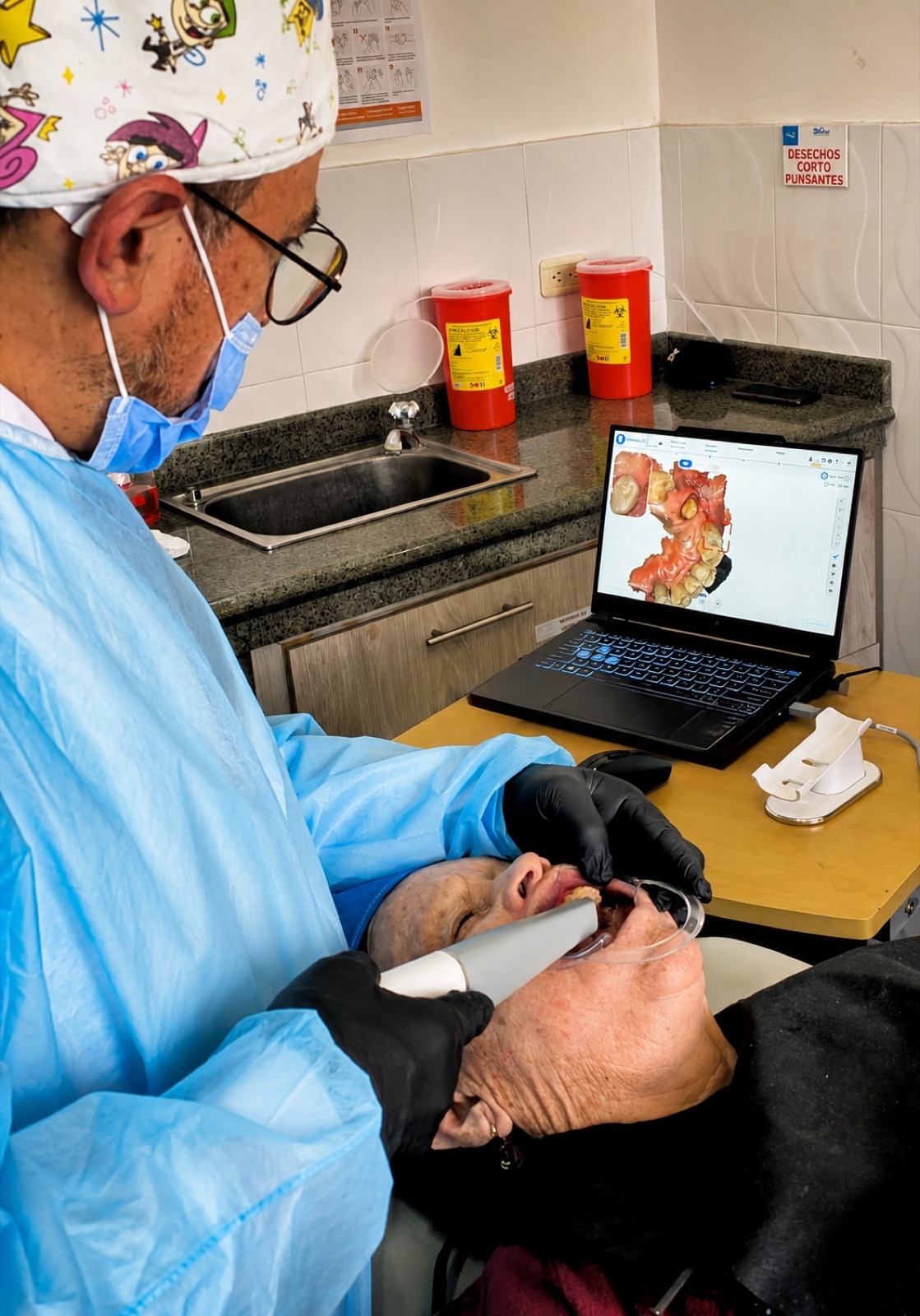 Planificación con escáner intraoral 3D — toma de la impresión digital